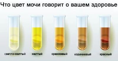 цвет мочи