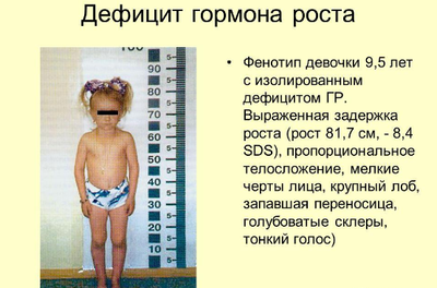 Дефицит соматотропина у детей