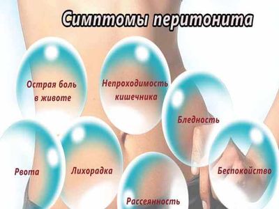 симптомы перитонита