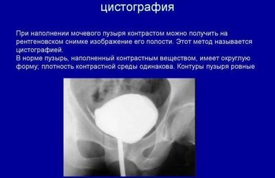 цистография