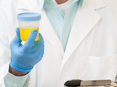 врач держит анализ мочи