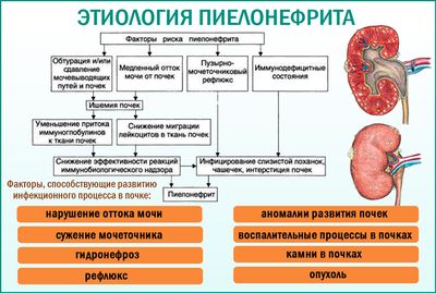 Пиелонефрит. Этиология. Патогенез