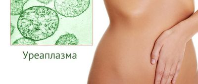 Уреаплазма при беременности введение