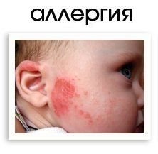 Цинковая мазь может спровоцировать аллергическую реакцию