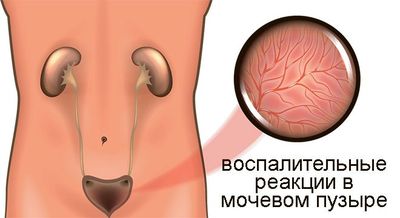 воспалиние
