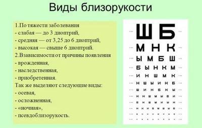 Виды близорукости