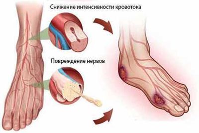 Больные ноги