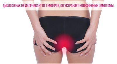 Диклофенак не устраняет геморрой полностью