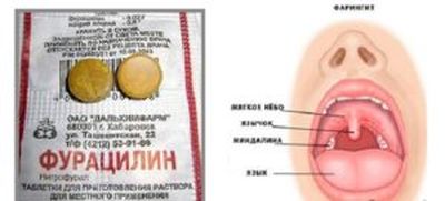 Лечение горла фурацилином