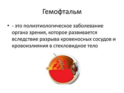 Частичный гемофтальм глаза