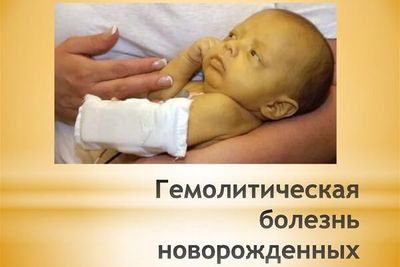 вид малыша при геморрагической болезни