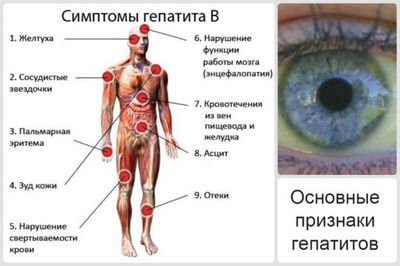 Симптомы гепатита B