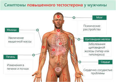 симптомы высокого тестостерона у мужчин
