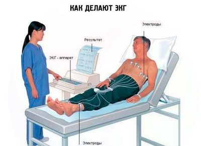 как делают экг