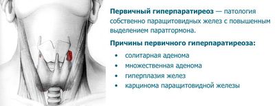 гиперпаратиреоз причины
