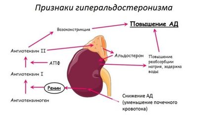 Гиперальдостеронизм