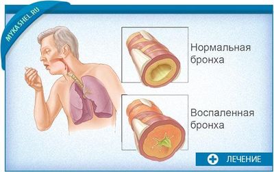 чем отличается норма от не нормы