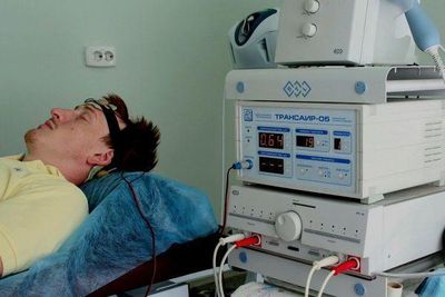 стимуляция мозга