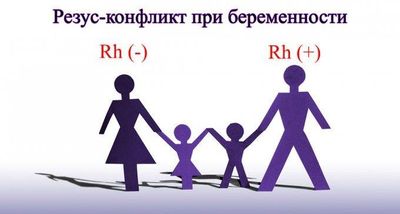 резус конфликт при беременности
