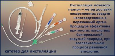 инстилляции