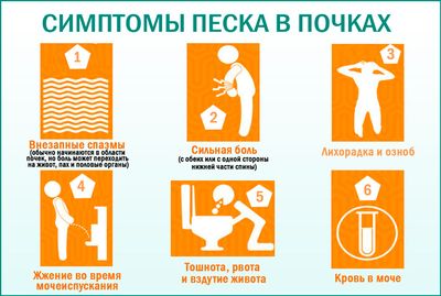 Песок в почках: симптомы