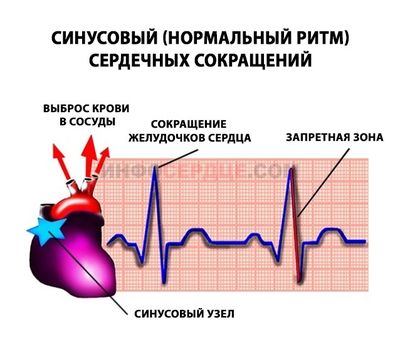 Синусовый ритм