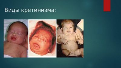 виды кретинизма