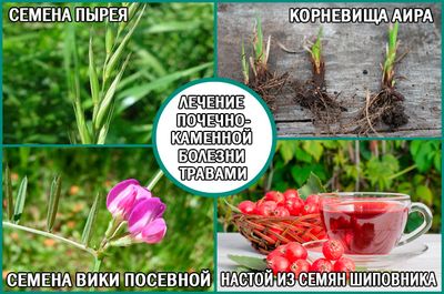 Почечнокаменная болезнь: лечение народными средствами