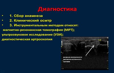 Диагностика повреждения мениска