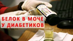Белок в моче у диабетиков