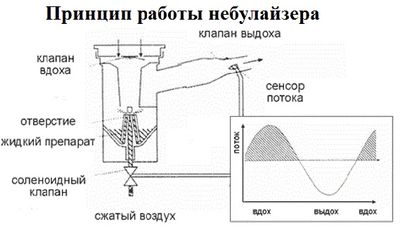 принцип работы небулайзера