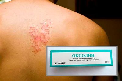 Для чего применяется Оксолиновая мазь: инструкция и отзывы