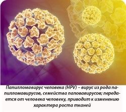 Папилломавирус человека