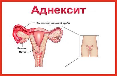 Анексит