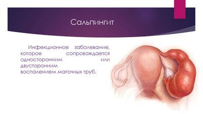 Сальпингит