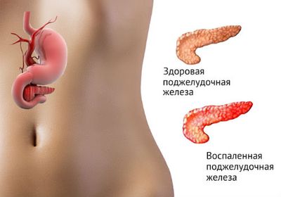 воспаленный внутренний орган