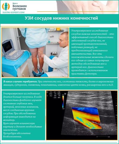 УЗИ сосудов нижних конечностей