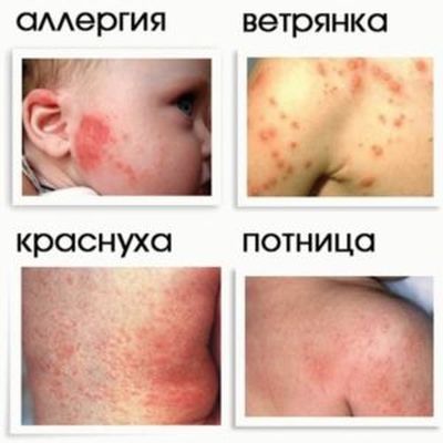 сыть