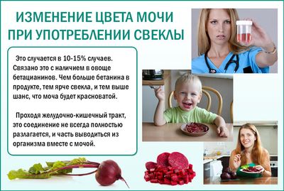 Почему меняется цвет мочи при употреблении свеклы