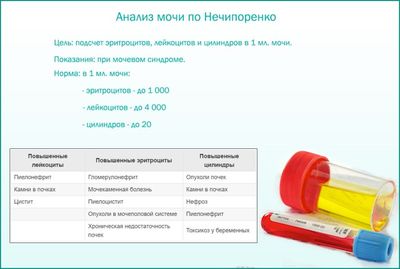 Результаты анализа мочи