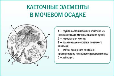 Анализ мочи под микроскопом