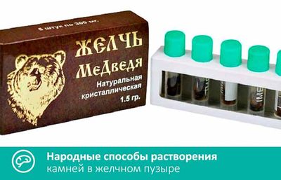 Народные способы растворения камней в желчном