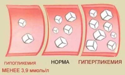 Показатели содержания сахара в крови