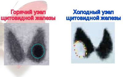 холодный и горячий узел фото
