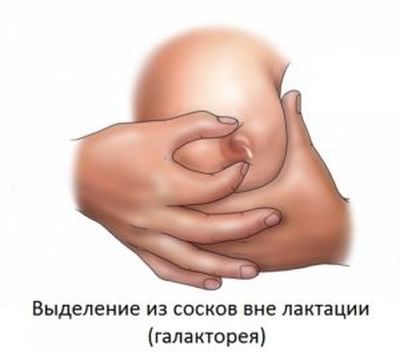 галакторея
