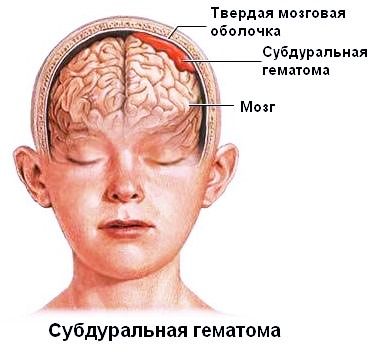 Голова