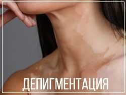 Депигментация кожи - аллергическая реакция на мазь тридерм
