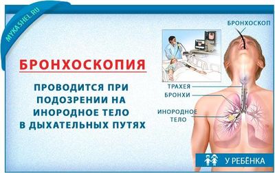 Бронхоскопия при рвоте у малыша