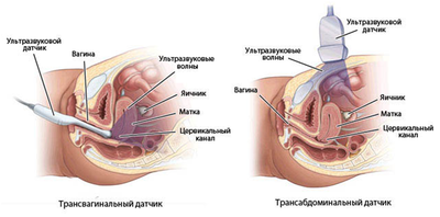 узи методы исследования