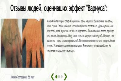 еффект вариуса